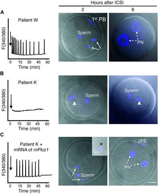 Applications of advances in mRNA-based platforms as therapeutics and diagnostics in reproductive technologies